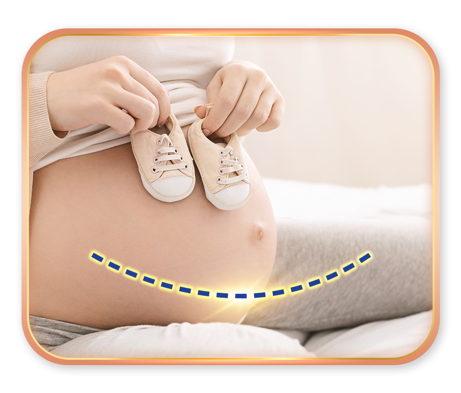 Pregnancy C-section -preparation01-02