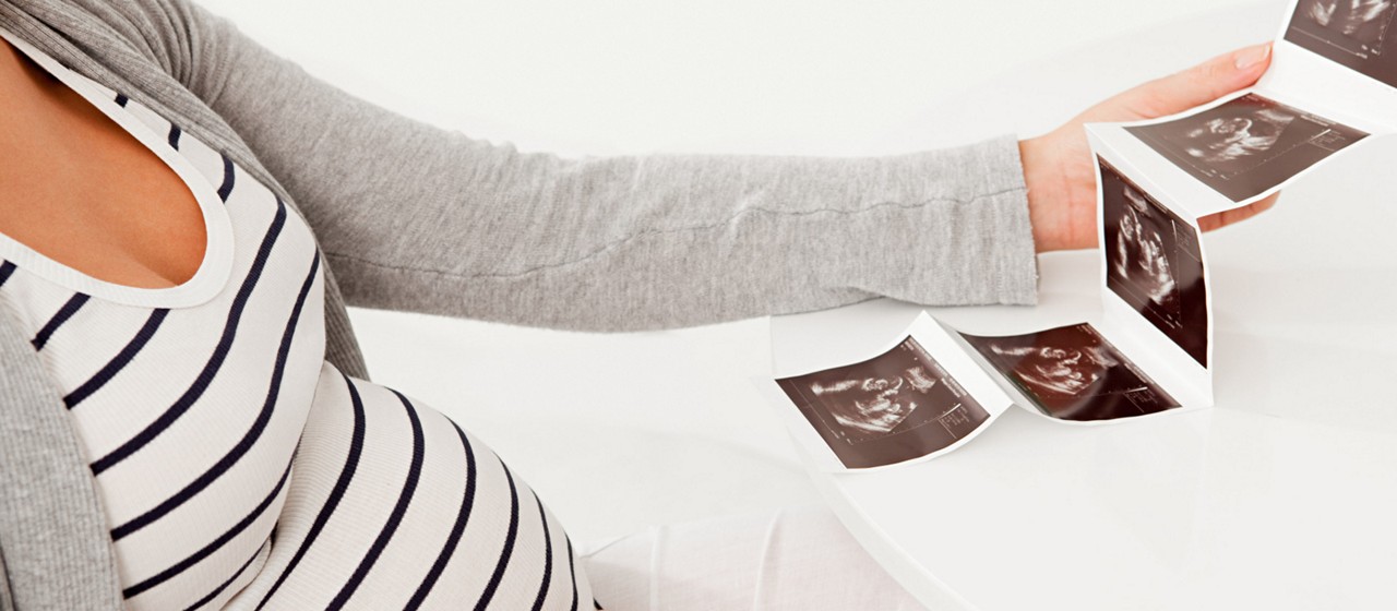 Schwangere mit Ultraschallfotos