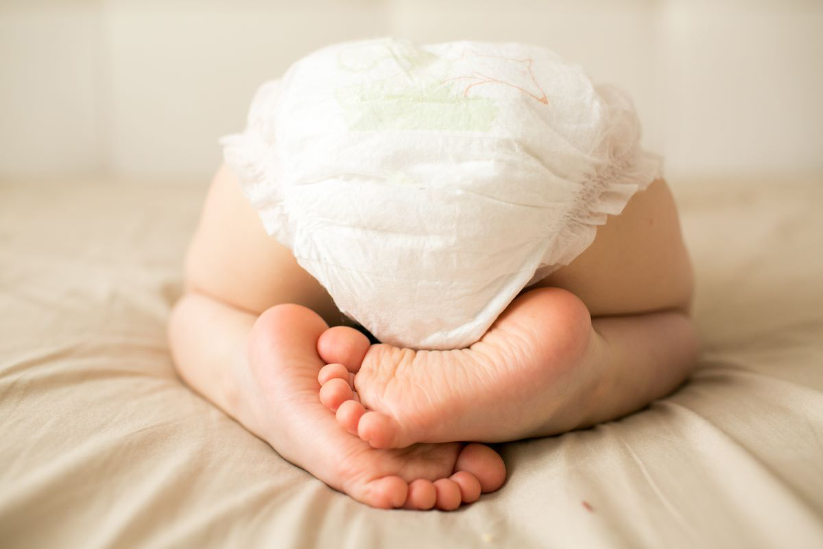 О чем расскажут ассиметричные складки на ножках у вашего малыша?