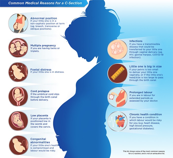 common-medical-reasons-for-a-c-section