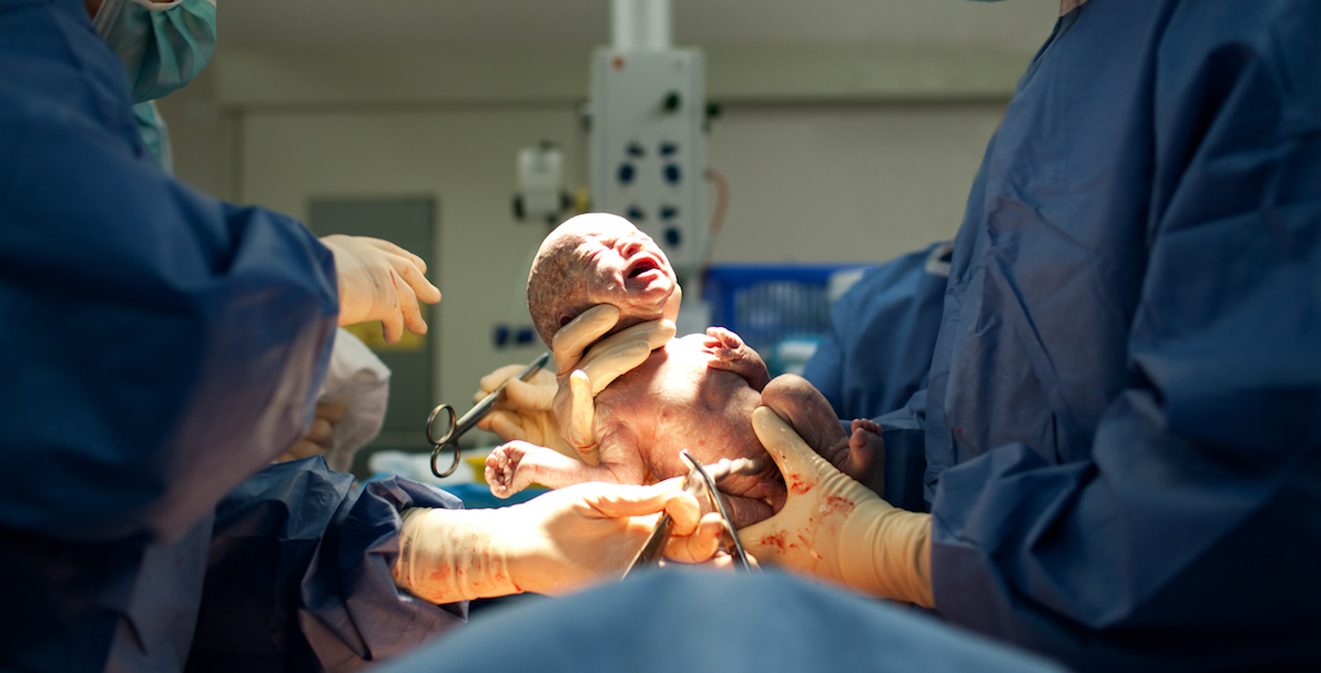 Hi Q caesarean need to know