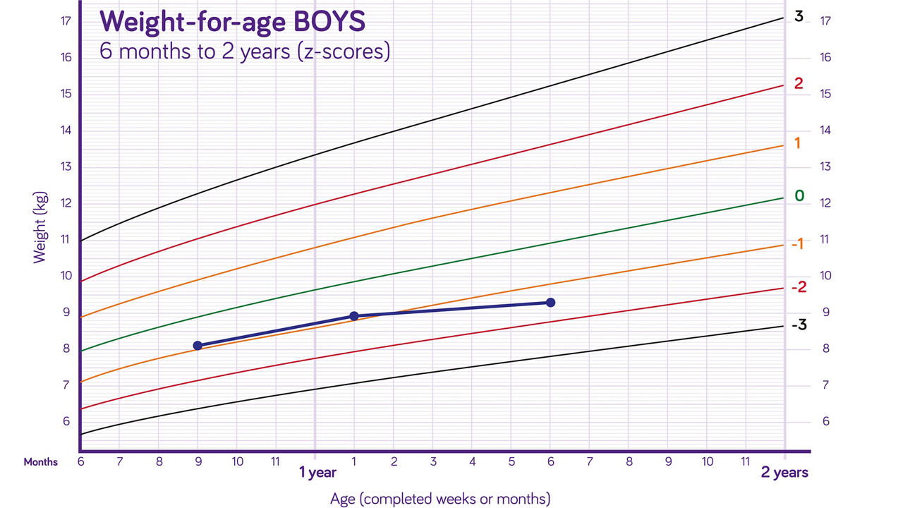 Nutricia pediatric DRM growth graph weight for age boys 6 months to two years z scores