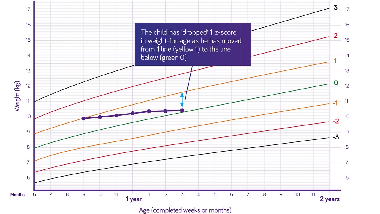 Nutricia pediatric DRM growth graph weight for age boys 6 months to two years z scores 2
