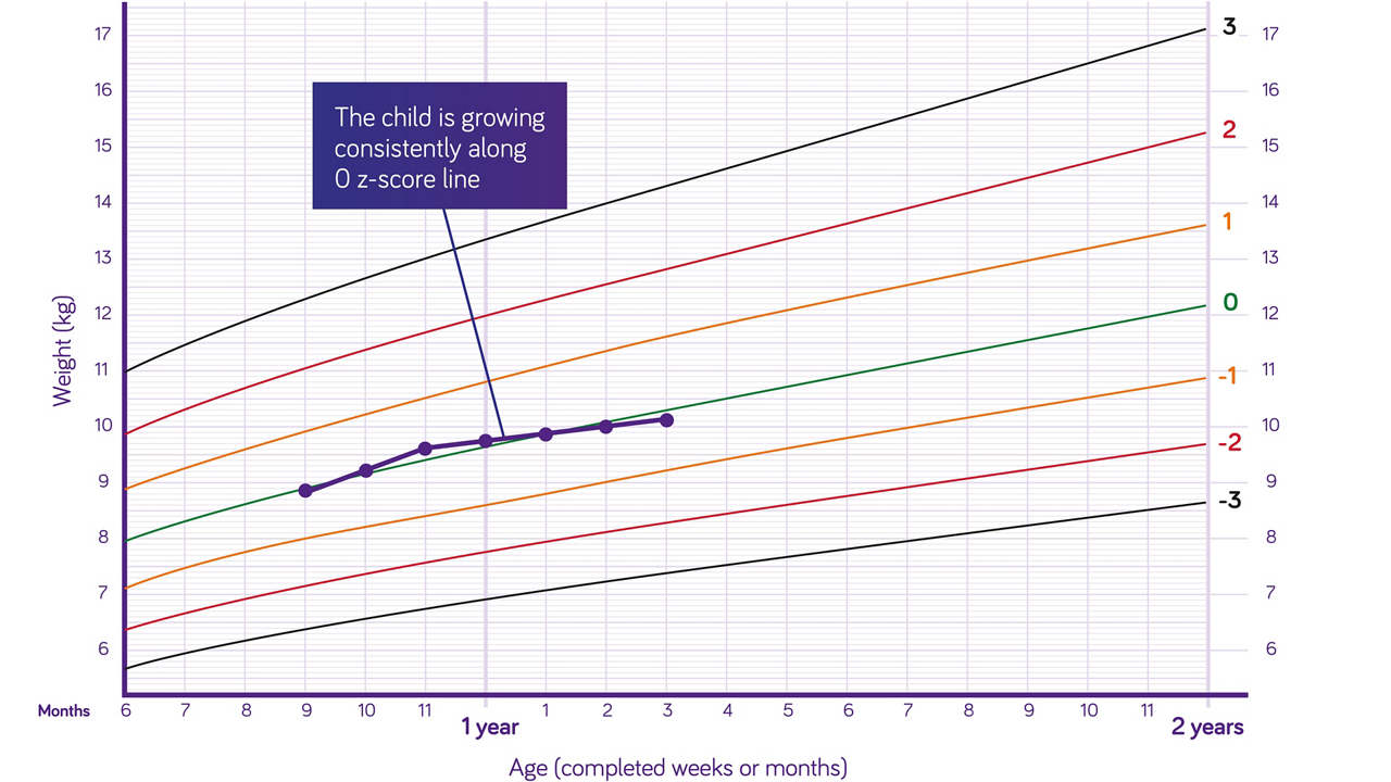 Nutricia pediatric DRM growth graph weight for age boys 6 months to two years z scores 3