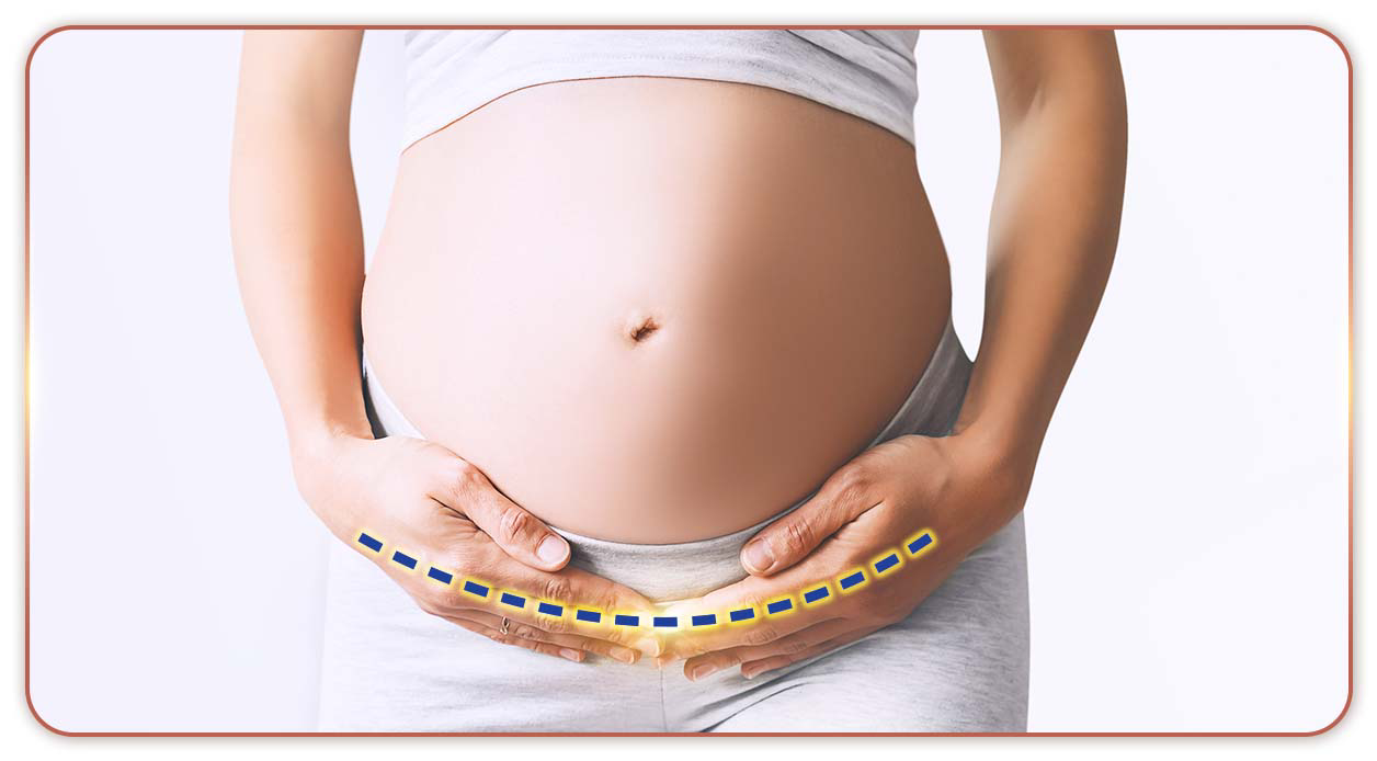 C-section care for caesarean wound (pic3)