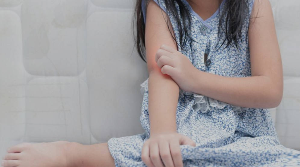 Girl sctratching allergy rash spot on skin