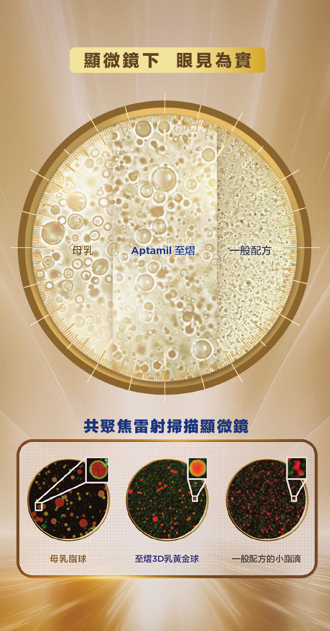 顯微鏡下眼見為實，母乳、Aptamil 至𦒉、一般配方，共聚焦雷射掃描顯微鏡：母乳脂球、至𦒉3D乳黃金球、一般配方的小脂滴