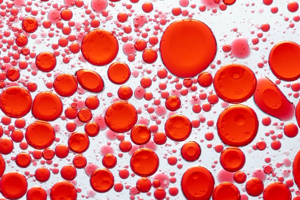thalassemia