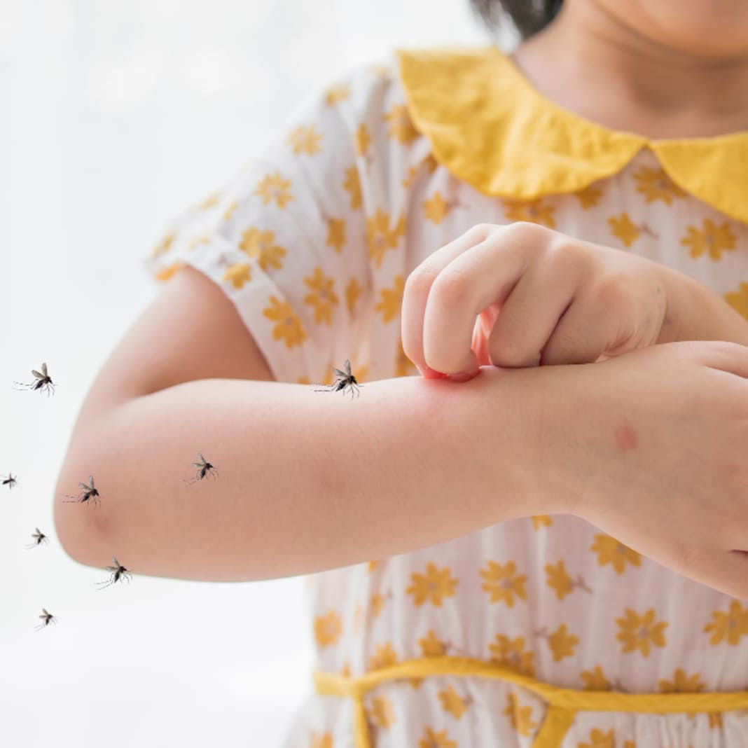 dengue-fever-symptoms-children