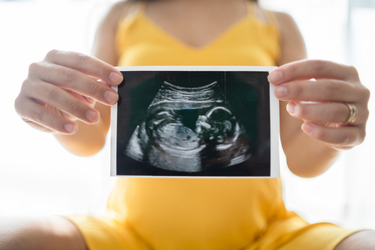 Pregnant woman with yellow dress holding ultrasound scan for her unborn baby.
