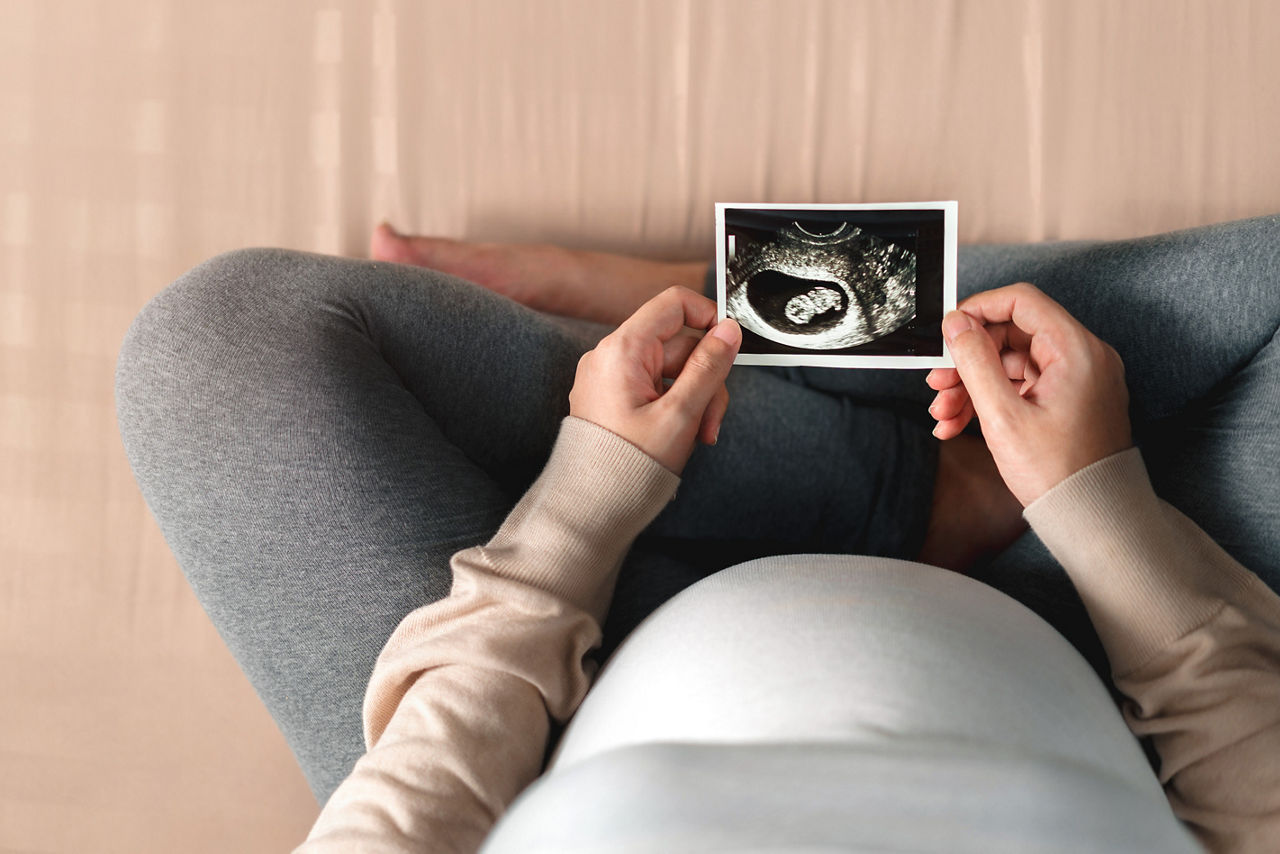 Asian pregnant woman holding ultrasound scan image, Expectation of a child and Maternity prenatal care and woman pregnancy concept.