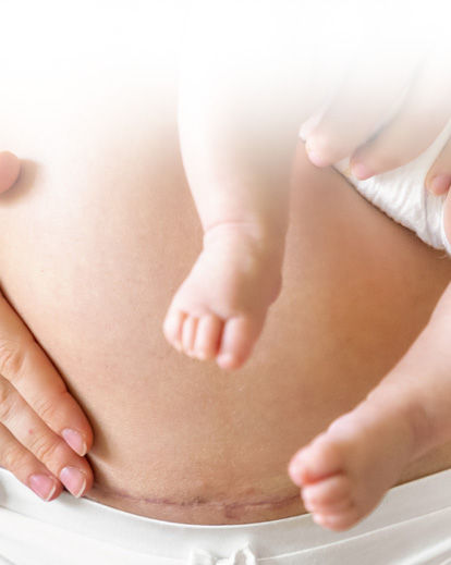 ក្រោយសម្រាលដោយវះកាត់ ម៉ាក់ៗគួរធ្វើ និងគួរចៀសវាងអ្វីខ្លះ?