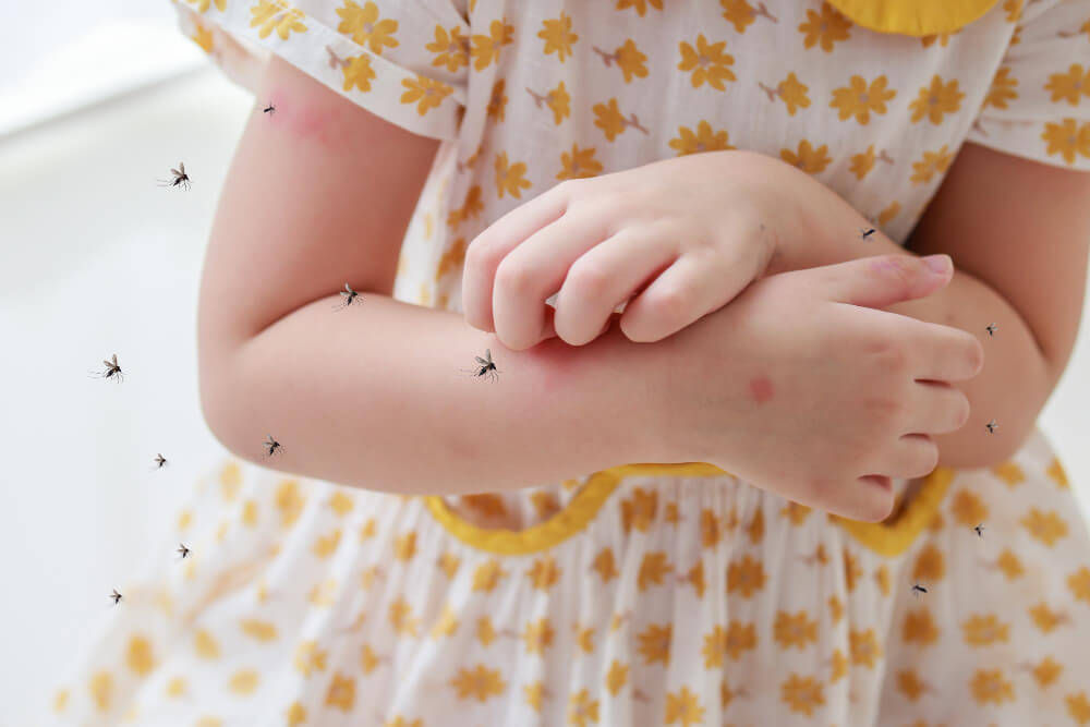 dengue-fever-symptoms-in-childrens