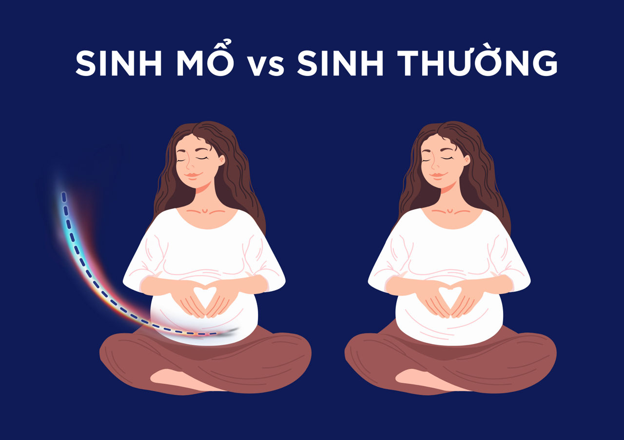 sinh mo vs sinh thuong