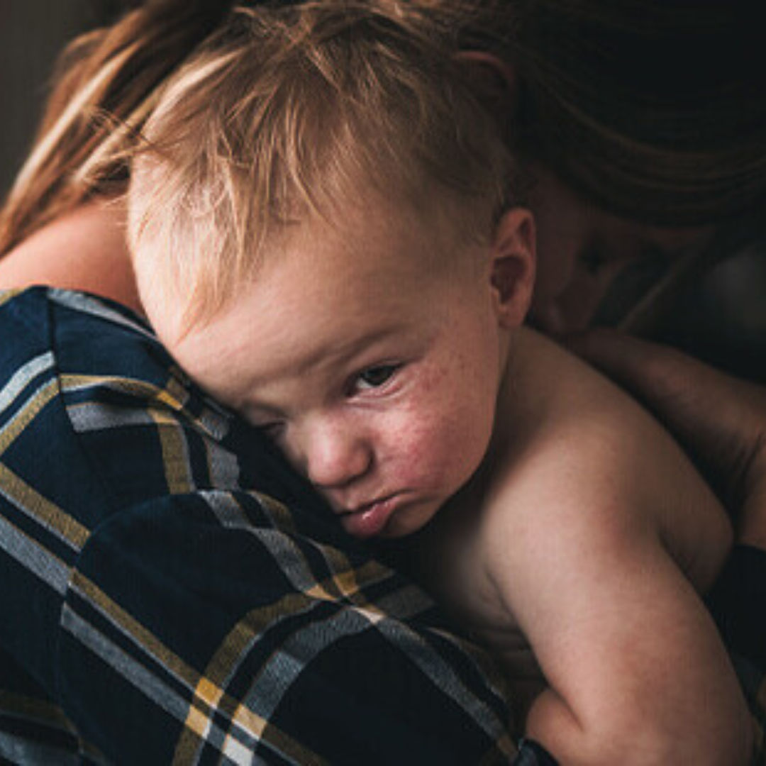 Untitled design - ALLER0026-Infant Functional Gastrointestinal Disorders