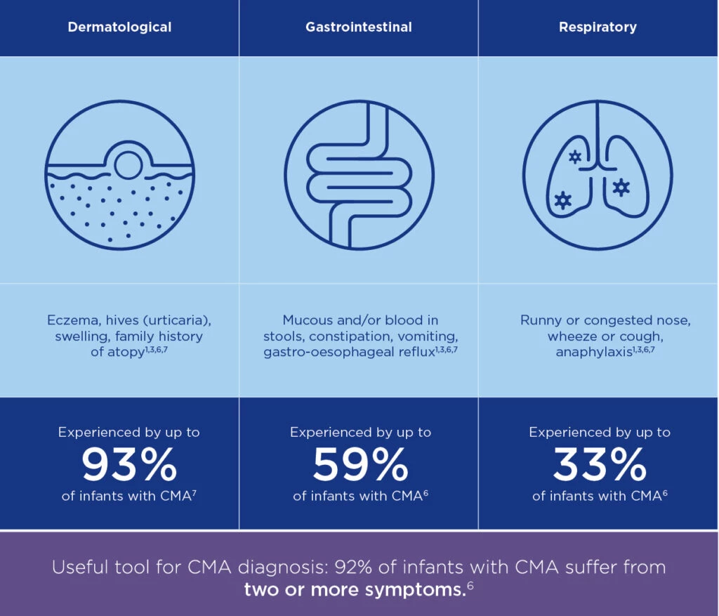 An infographic illustrating symptoms of CMA across dermatological, gastrointestinal, and respiratory categories. Includes visual representations of eczema, digestive issues, and respiratory problems. Highlights statistical data: 93%, 59%, and 33% of infants experience respective symptoms, with 92% showing two or more symptoms.