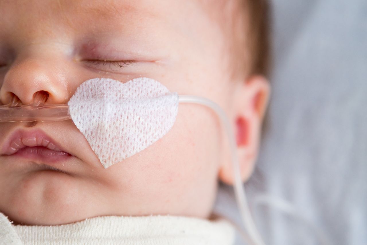 Newborn baby in hospital weakened with bronchitis is getting oxygen via nasal prongs to assure oxygen saturation, Newborn baby in hospital weakened with bronchitis is getting oxy