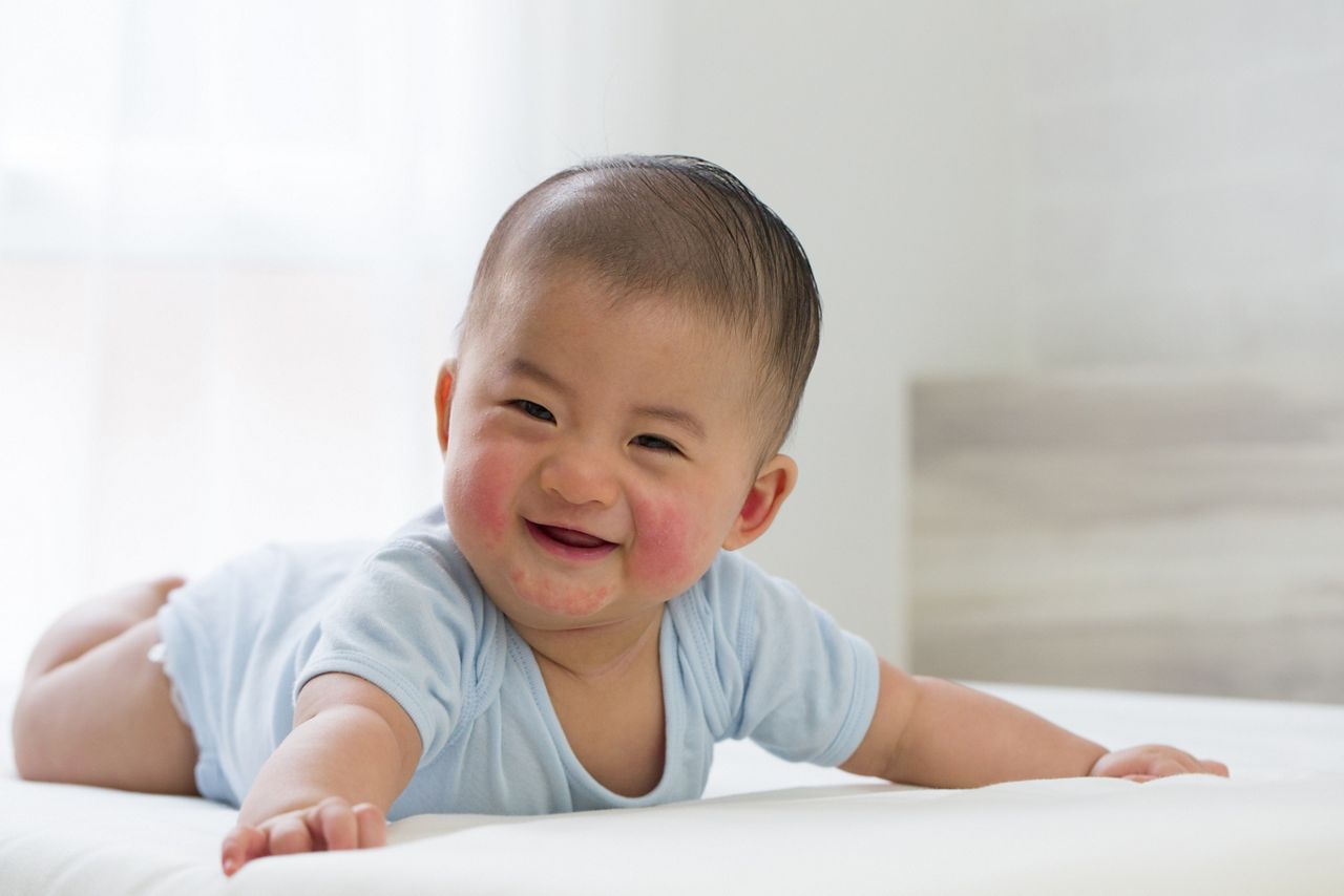 Childhood rashes, skin conditions and infections concept