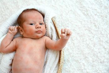 Little child with red rash lying in cradle, top view. Baby allergies
