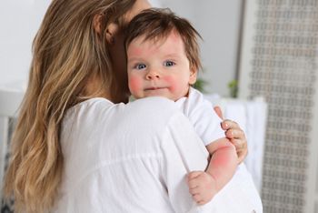 Mother hugging her cute daughter at home. Little baby with allergic redness