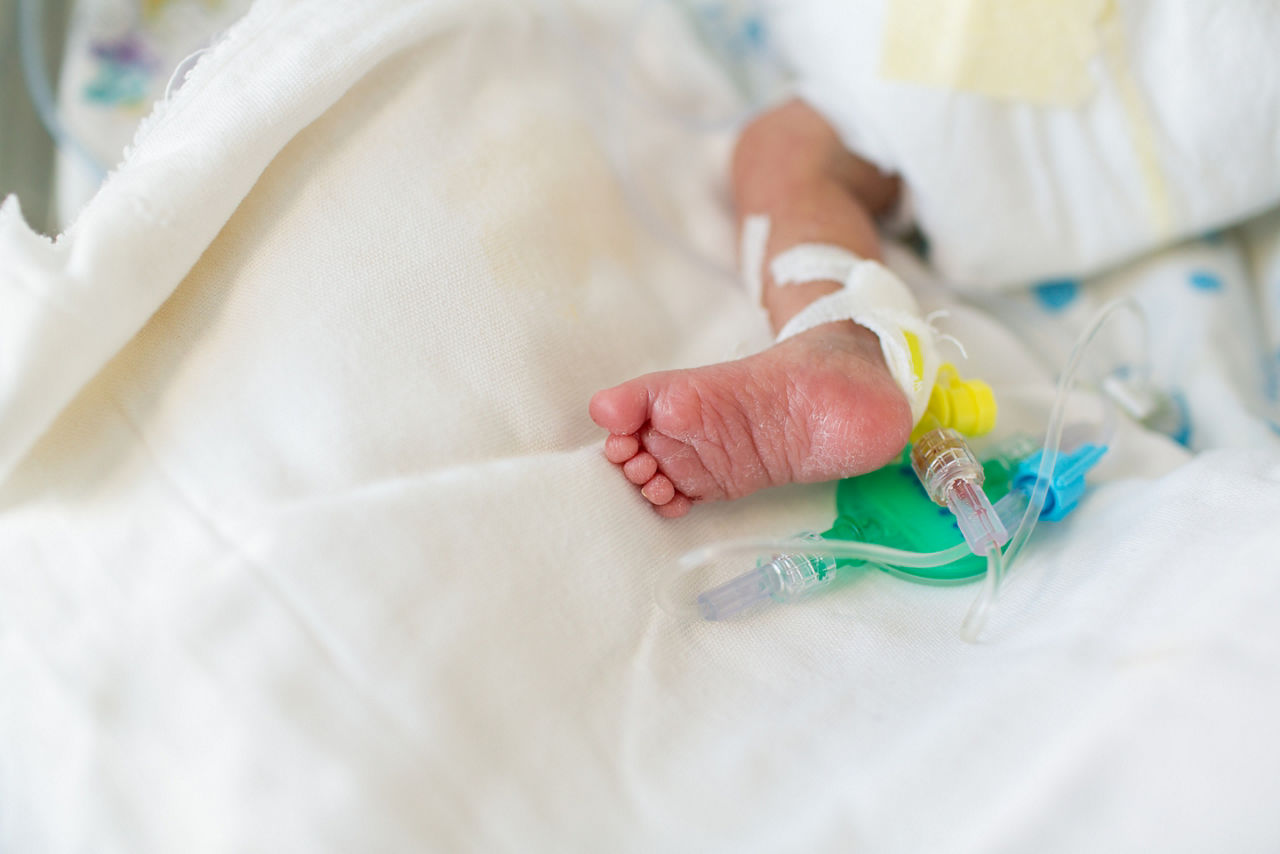 premature baby legs with neonatal infant pulse oximeter and a catheter