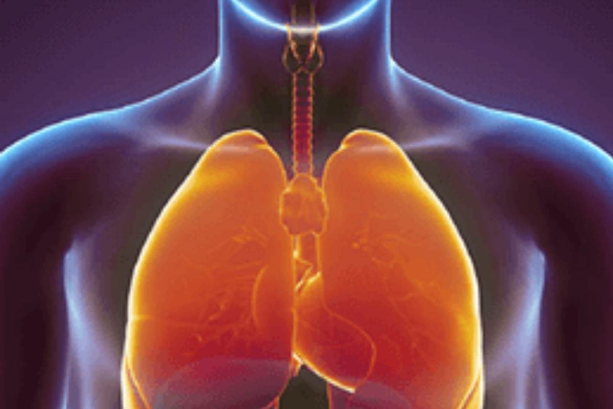 COPD model