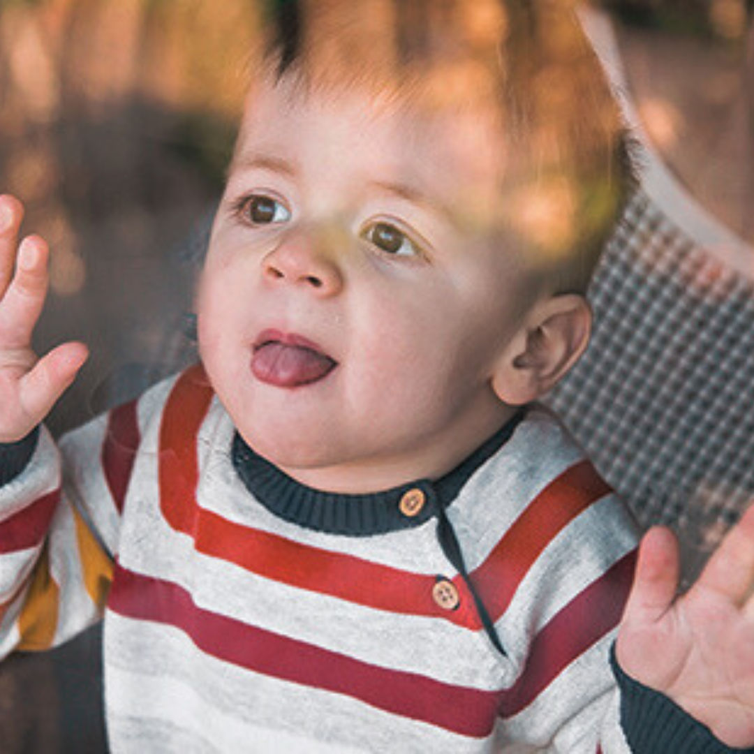 Untitled design - Cows’ Milk Protein Allergy