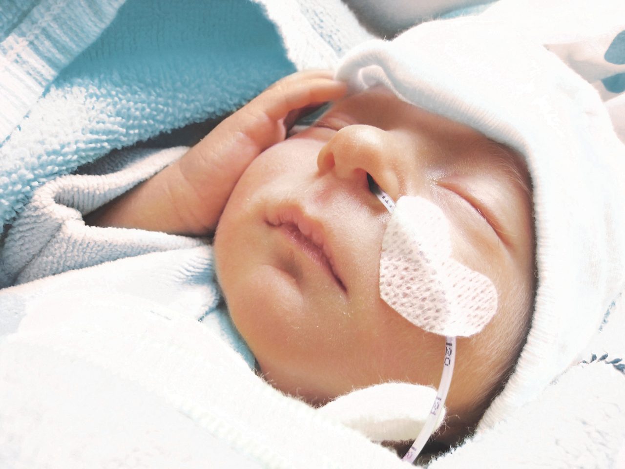 Frühgeborenes mit Nasensonde und Pflaster in Herzform schläft