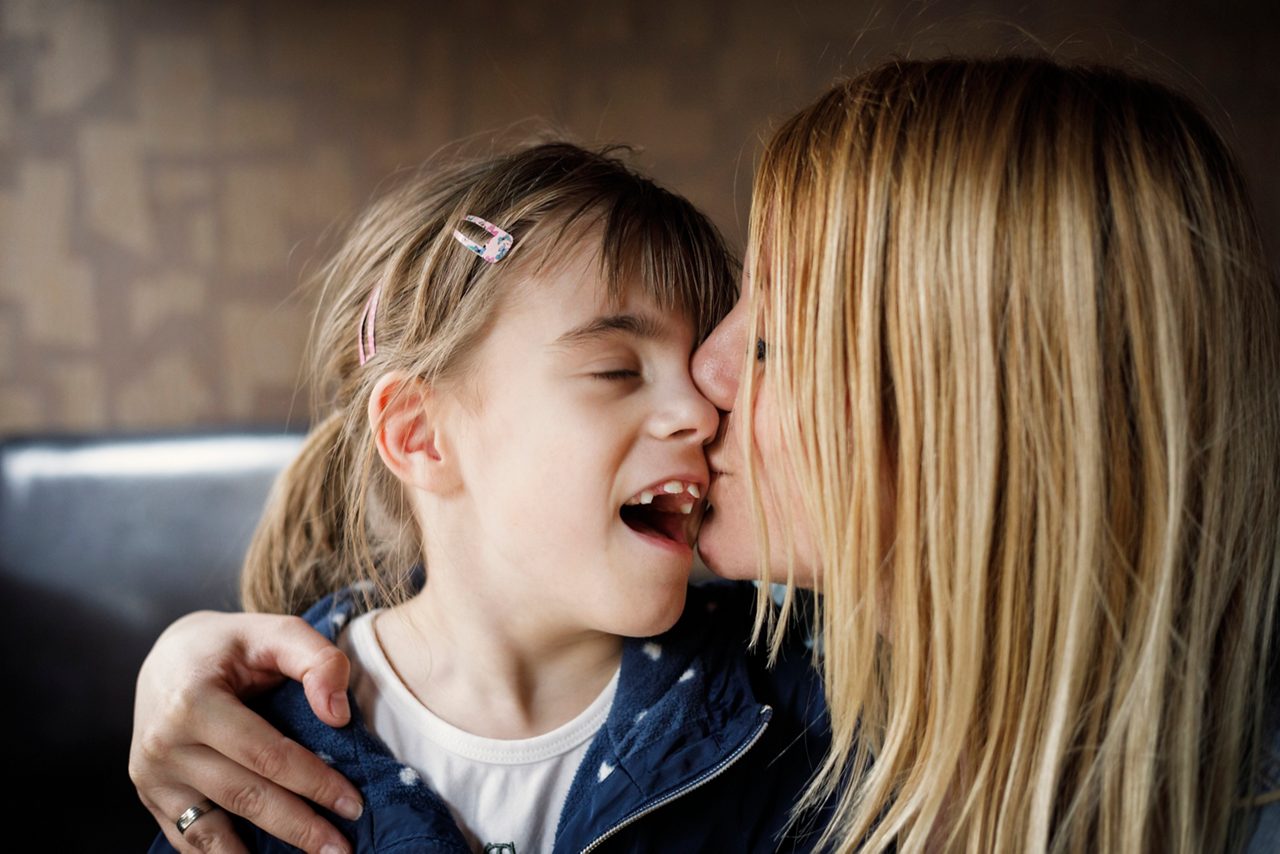 Mother is kissing her daughter that has visual impairment. Genuine emotions, real people.