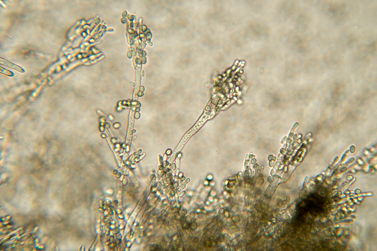 Photomicrograph of 