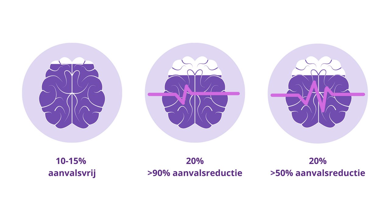 47% aanvalsvrij bij 1e anti-epilepticum