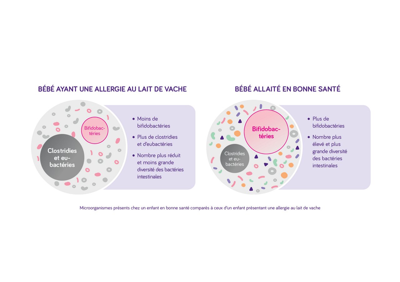 Comparaison des bactéries intestinales d'une allergie au lait de vache avec un bébé en bonne santé