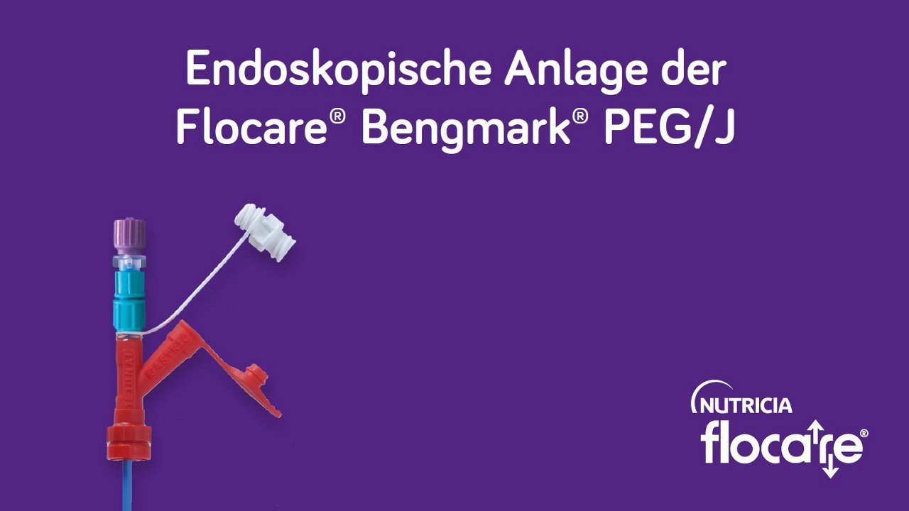 endoskopische anlage der flocare bengmark peg/j