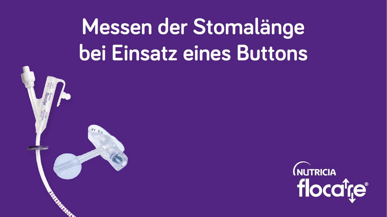 messen der stomalaenge bei ensatz eines buttons