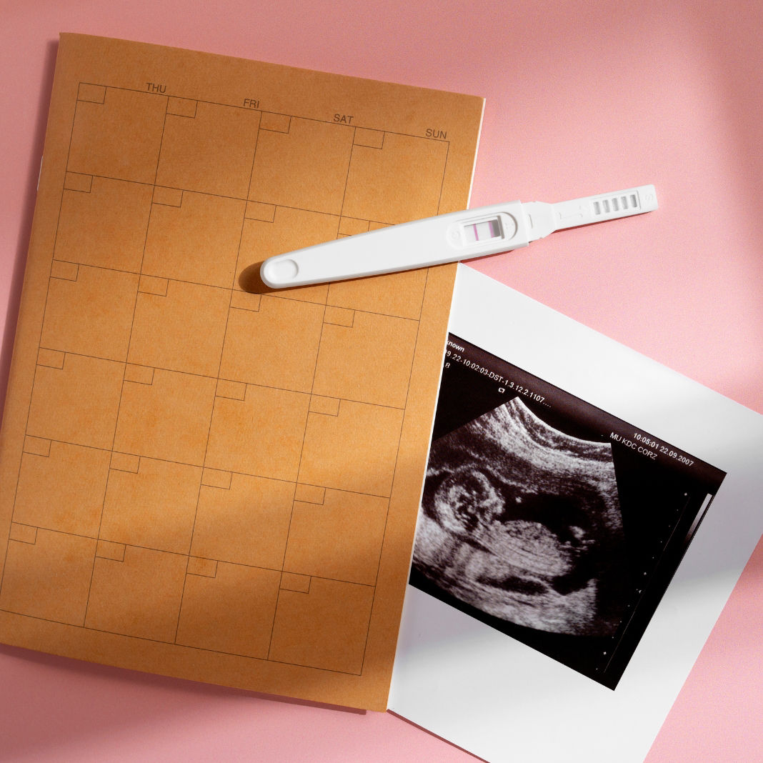 สมุดฝากครรภ์