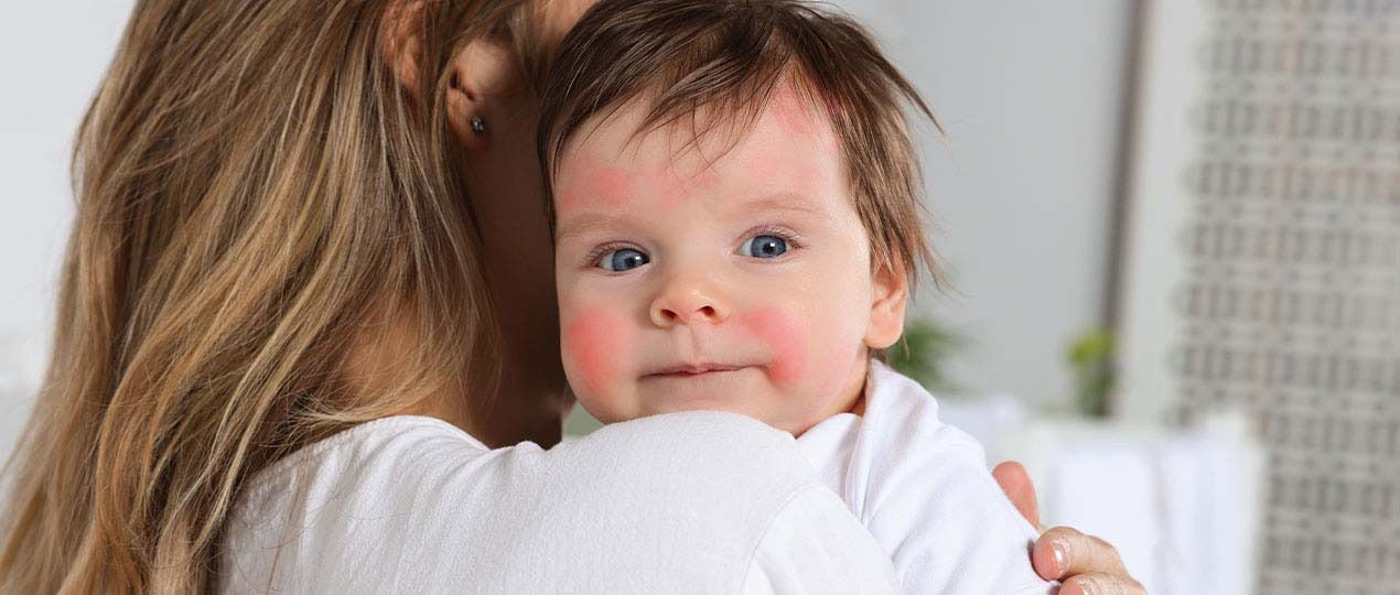 Hypoallergenic formula
