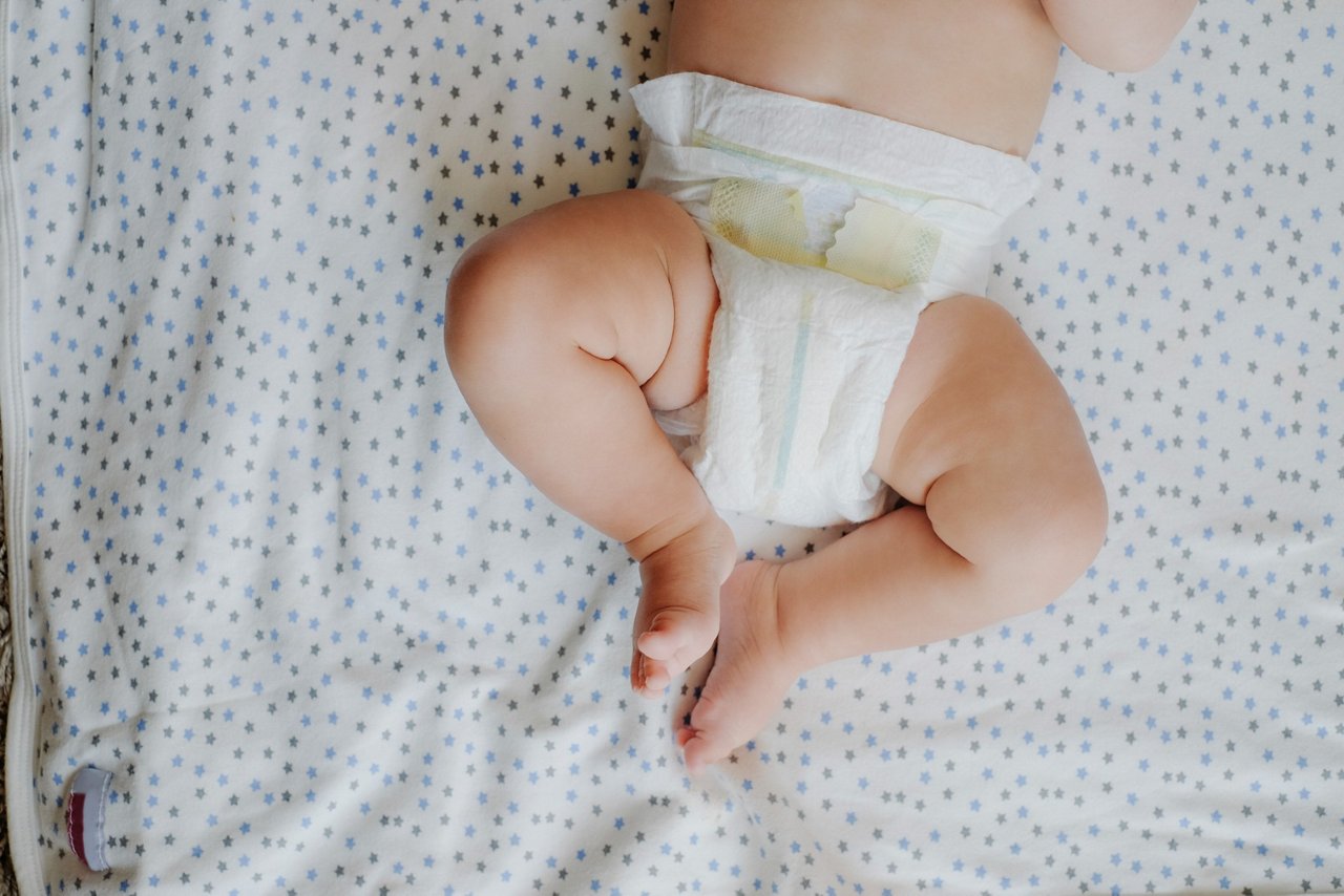 Baby mit Windelsoor liegt auf gepunkteter Decke