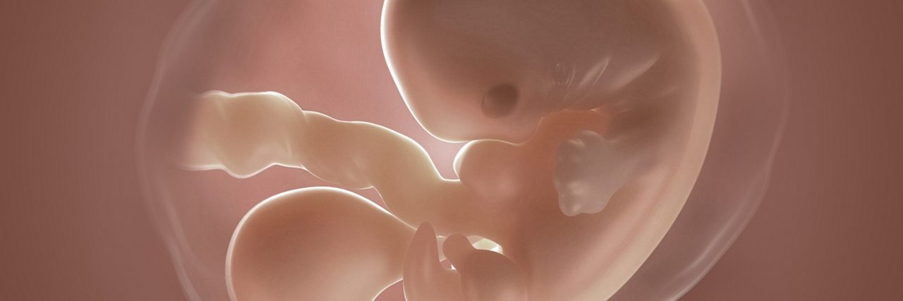 Embryo in der 5 Schwangerschaftswoche