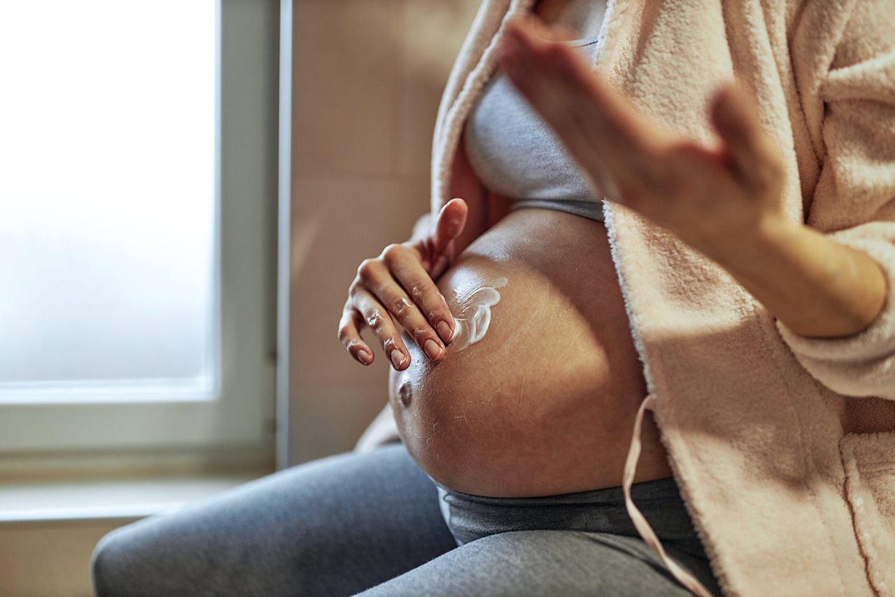 Schwangerschaftsstreifen - Schwangere Frau cremt sich bauch ein