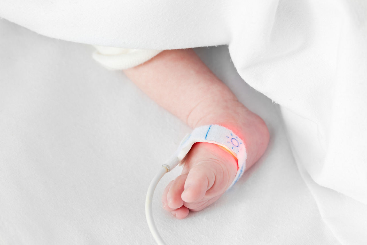 Close up of a pre-term foot with a NICU baby monitor