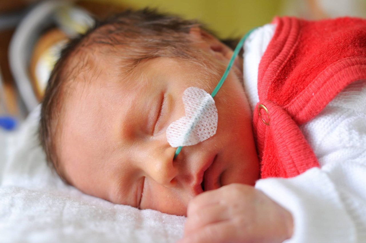 Frühgeborenes mit Nasensonde und Pflaster in Herzform schläft