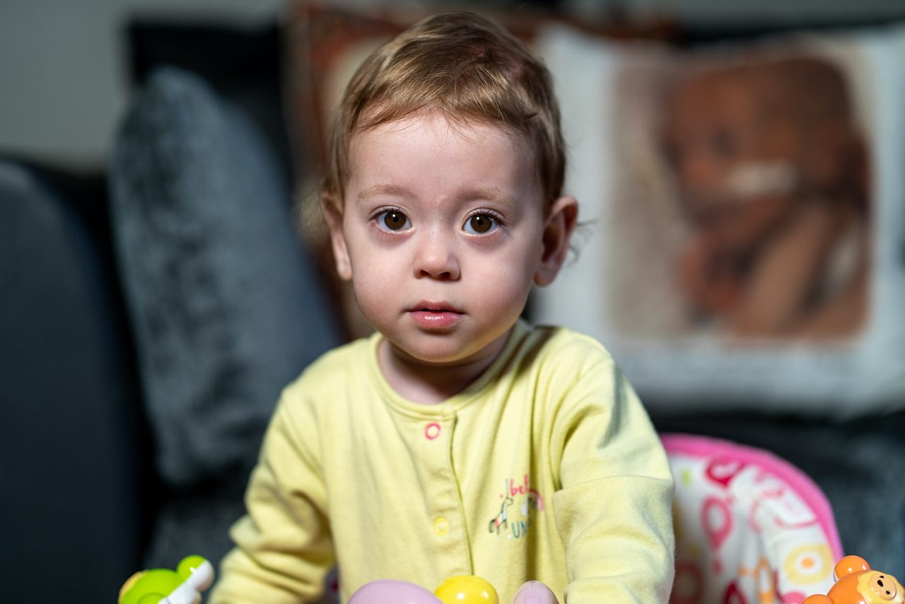 Cow's milk allergy little girl in her crib