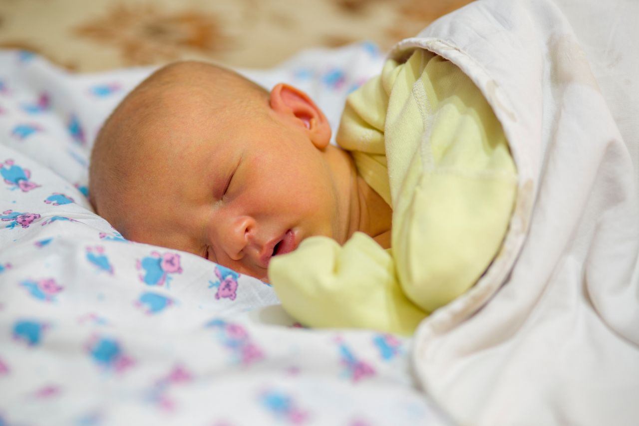 Jaundice in a newborn baby