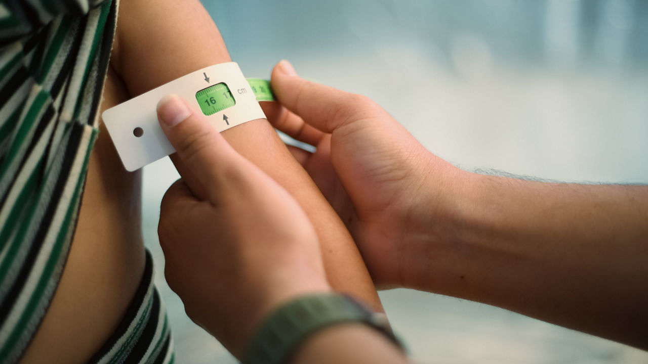 Malnutrition was measured using a mid-upper arm circumference belt