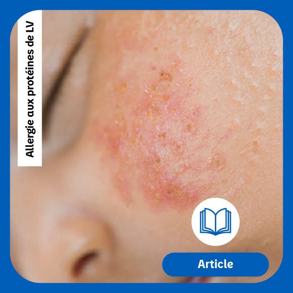 Vignette Article APLV DSN