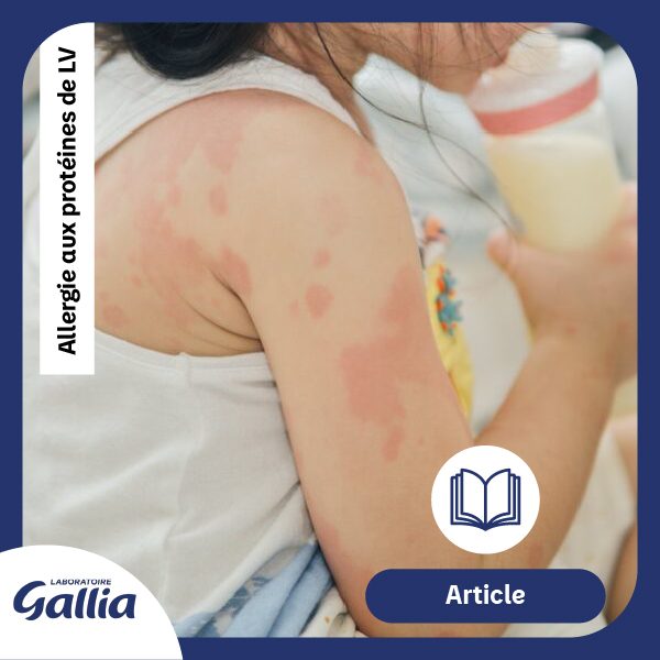 Vignette Article APLV Gallia