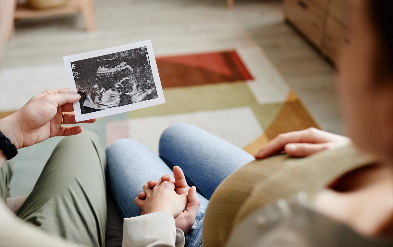 Paar mit Ultraschallbild in der Hand