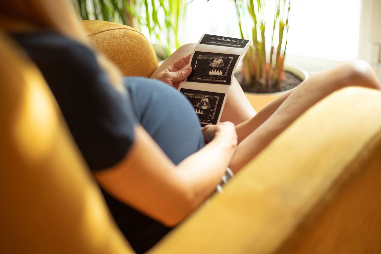 Schwangere Frau schaut ein Ultraschallbild an