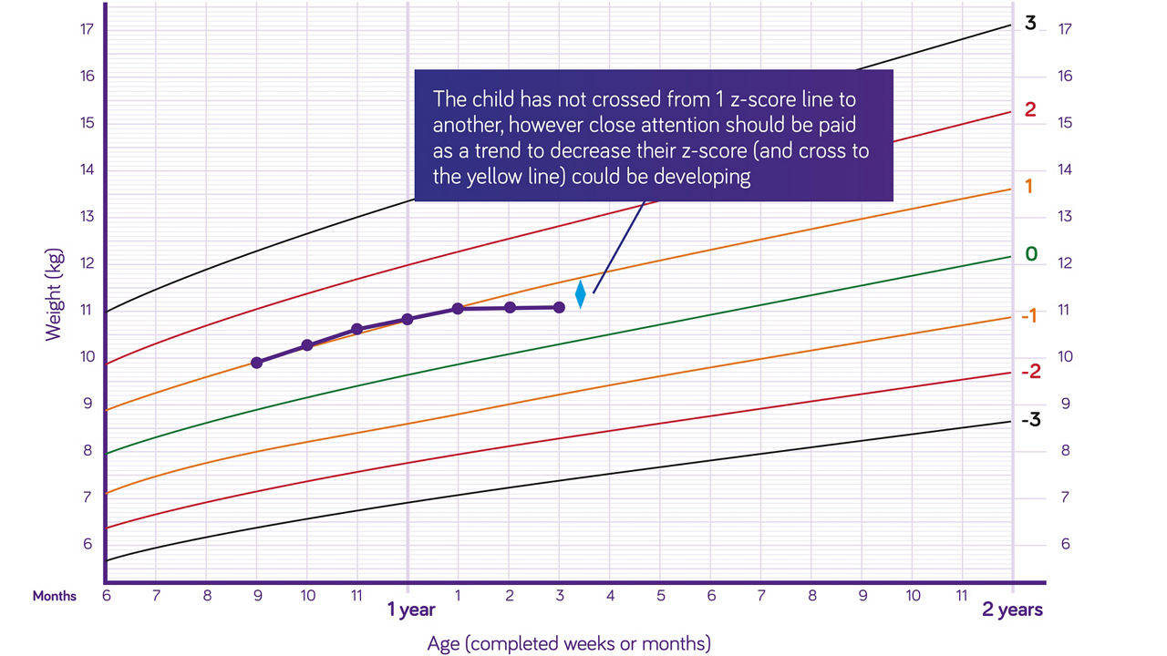 Height growth charts with mean, ± 1 SD, and ± 2 SD lines (Z-score