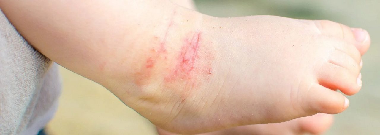 scorad-erhoeht-jetzt-handeln